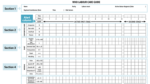 Monitoring Labor with the Partograph and Labor Care Guide